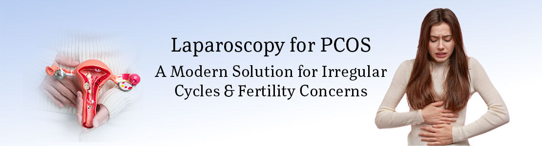 Laparoscopy for PCOS: A Modern Solution for Irregular Cycles and Fertility Concerns